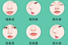 北京夏正义做鼻子和鼻修复手术怎么样?夏正义做鼻子的风格很自然!