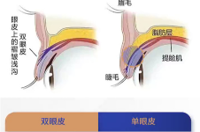 大庆圣熹美医疗美容怎么样?做眼睛出名,是大庆正规整形医院排名前十实力!