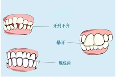 苏州好的口腔医院有哪些？苏州牙齿矫正哪家好？