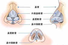 广州男生隆鼻多少钱？男生隆鼻整形医院哪家效果好