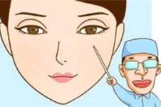 宁波双眼皮手术案例分享 看哪家医院双眼皮手术做的好