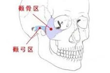 广州颧骨手术哪家整形医院做的好?推荐广州颧骨内推医院