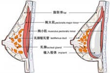 求助贴:贵阳做假体丰胸一般多少钱?哪家医院做的好一点