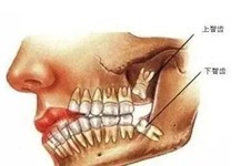 安顺拔智齿要花多少钱？拔智齿哪家口腔机构擅长？