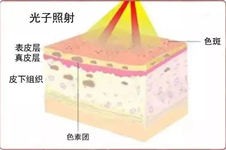 贵阳哪里做光子嫩肤好？贵阳光子嫩肤价格一览表