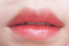 厚唇改薄手术方法是什么样？韩国HB医院告诉你有没有副作用