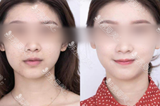 首尔超有名气的皮肤管理中心推荐（1）：韩国LAMICHE整形皮肤