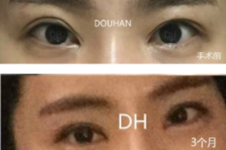 韩国眼部修复十大出名医生盘点，厉害医生学术背景也牛！
