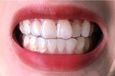成都牙齿矫正医院排名前十, 均为成都正规可靠的正畸牙科!