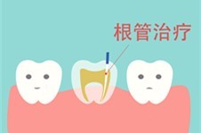 牙烂到什么程度要根管治疗?自测这个三个阶段您处于哪一个?