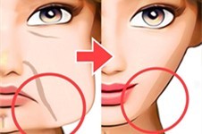 做拉皮手术的疤痕图片集合:小切口VS大拉皮留疤均不同!