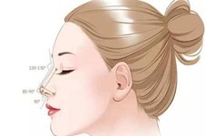 科普贴:歪鼻矫正手术成功率为多少,取决于医生和医院!