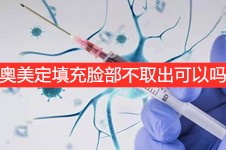 奧美定填充臉部不取出可以嗎?征集大量實例奧美定不得不取!