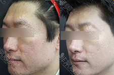 韩国有名的皮肤管理中心有哪些？去黑头缩毛孔效果好吗？