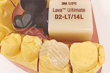 LAVA全瓷牙价格有高有低,系列型号太多搞不清型号都白搭!
