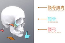 杭州颧骨手术多少钱?分享杭州颧骨降低、内推价格表!