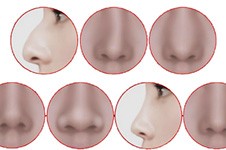 韩国高难度鼻修复医生介绍,还做手术、技术又好、审美在线