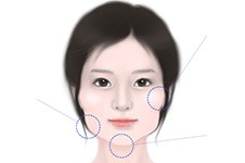 花十万到韩国改脸型可以吗?想知道韩国改脸型需要多少钱