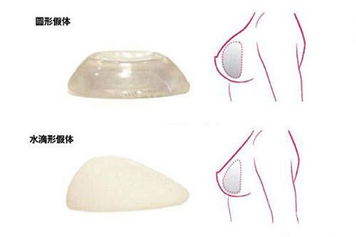 圆盘乳好看还是水滴乳好看,还得从两者的区别及优缺点来说