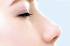计划隆鼻的美宝看过来:隆鼻术后的10大注意事项你必须了解!