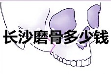 谁有长沙磨骨手术费价格表?准备用6万元做颧骨磨骨够吗?