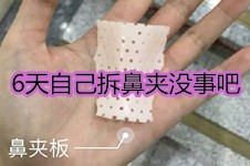 求助:6天自己拆鼻夹没事吧?鼻夹板拆早了会怎么样?(已答)