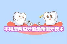 有不用磨两边牙的最新镶牙技术吗?急求不伤邻牙的镶牙方法!