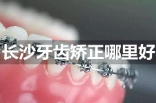 长沙矫正牙齿去什么医院比较好?做正畸前建议看看这份名单!