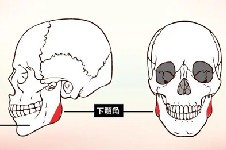 下颌角手术选韩国还是中国?了解韩国VG百利酷整形后再决定!