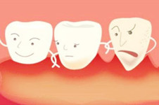 如何判断自己有没有牙周炎?牙周炎与牙龈炎区别是什么?附图