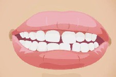 牙齿瓷贴面能解决牙缝大的问题吗?过来人告诉你牙贴面感受