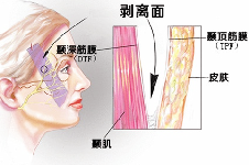 合肥哪個(gè)醫(yī)院做面部提升好?推薦芬格嘉美整形面部拉皮提升