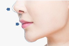 韩国温度人中鼻整形打造漂亮的45°角轮廓,平衡鼻子年轻精致