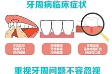 2021湘潭新的牙科价格多少钱？种植牙一颗的价格变化不大！