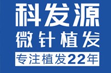 西安种植头发1000单位大概需要多少钱？看2021年植发价格表！