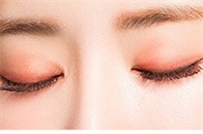 桂林时光医疗美容眼综合手术怎么样？双眼皮有什么特色？