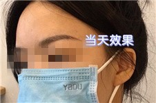 南寧芭芘麗醫(yī)療美容正規(guī)嗎？自體脂肪豐胸價格貴不貴？