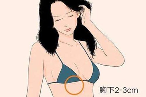 为什么很多女孩胸下面一条疤?揭晓女性的乳房秘密!