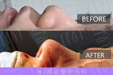 分享韩国眼鼻整形医院—韩国WJ原辰,附各院长眼鼻手术对比!