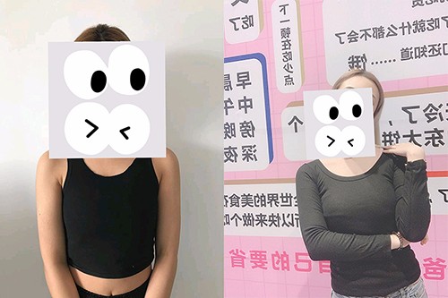 贵阳哪家医院做假体丰胸好?贵阳利美康鲁天宇隆胸好吗?