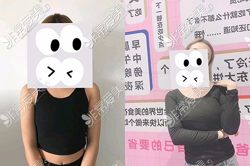 贵阳隆胸医院哪家比较好?盘点贵阳隆胸口碑医院医生名单!