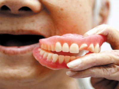 福州做全口假牙大概需要多少钱?全口义齿和种牙费用全解!