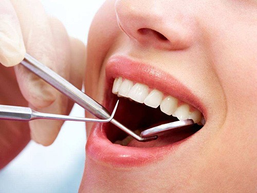 为何有人说相信牙医牙齿越治越坏?这些口腔传闻是真的吗?