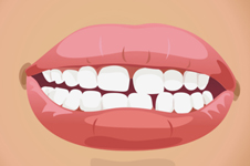 门牙缝隙越变越大怎么办？是什么原因造成？该如何修复？