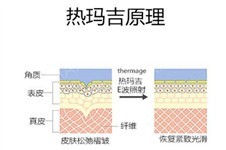 40岁做线雕还是热玛吉效果好？两者原理详解看看哪一款好！