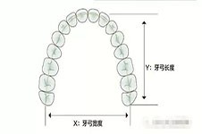 小孩牙弓窄早期矫正有必要吗？这些情况家长要了解