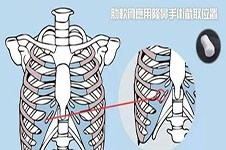 全肋骨隆鼻的利弊有哪些？多方位分析全肋骨隆鼻