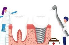 2022通化種植牙價(jià)格表更新，通化種植牙單顆全口半口價(jià)格