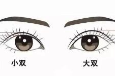 韩国me双眼皮是什么技术,可靠吗？与5m无痕双眼皮是一回事？