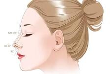 韩国WOOA妩阿整形外科鼻整形优势多多，来看鼻整形项目介绍